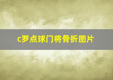 c罗点球门将骨折图片