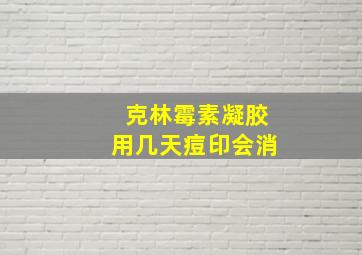 克林霉素凝胶用几天痘印会消