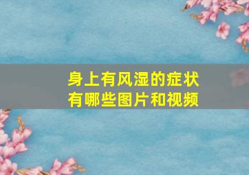 身上有风湿的症状有哪些图片和视频