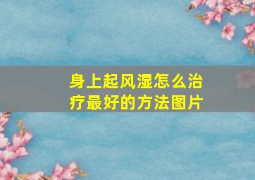 身上起风湿怎么治疗最好的方法图片